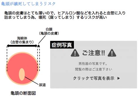 亀頭 冷たい|勃起時に亀頭の部分が固く大きくならない(やわらかい、血が。